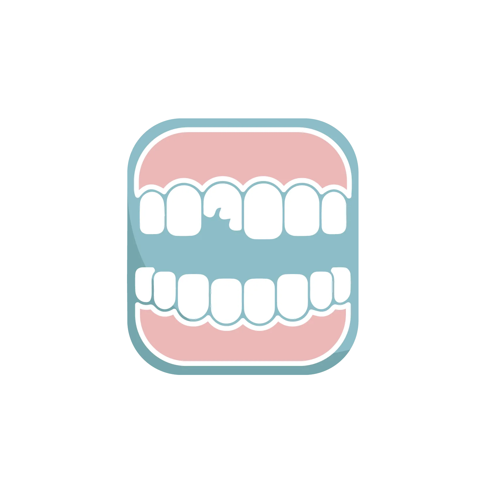 Fracturas dentales